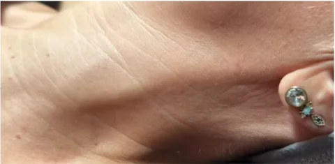 Hals voor micro-infusie